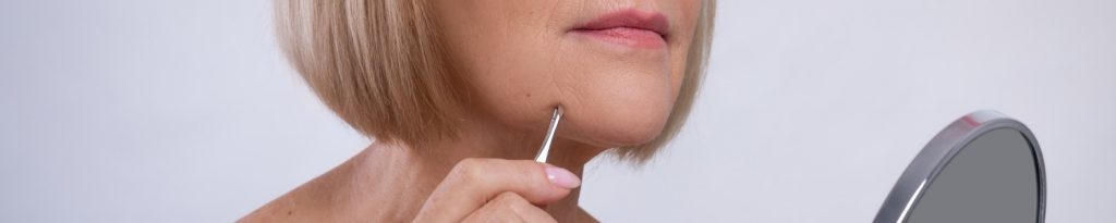 How To Get Rid Of Dark Spots On Chin From Plucking