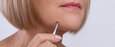 How To Get Rid Of Dark Spots on Chin Due to Hair Plucking